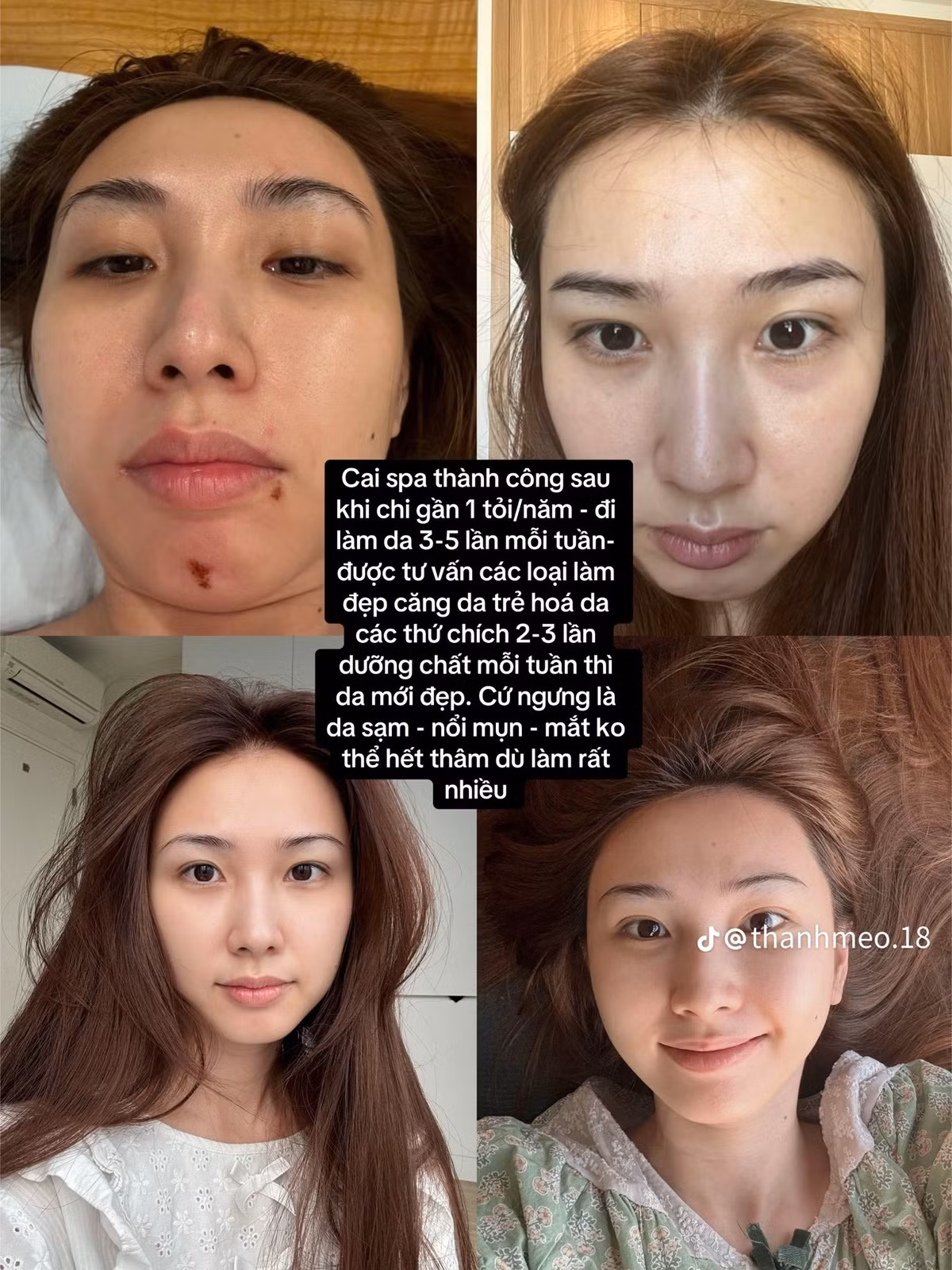 Hiện tại, cô tập trung vào việc chăm sóc sức khỏe từ bên trong. "Sau khi quyết tâm ngủ sớm - dậy sớm, nuôi dưỡng nội tâm bên trong, da tự cân bằng, ko bị kích ứng linh tinh, phải nói là đẹp hơn x10 dù gần 1 năm ko đi chăm sóc da." (Ảnh: @thanhmeo.18)