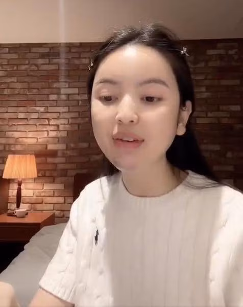 Xuất hiện trên một livestream gần đây, Chu Thanh Huyền - bà xã của cầu thủ Quang Hải để lộ vùng cằm có nhiều vết bầm tím rõ rệt khiến nhiều người bày tỏ sự thắc mắc về nguyên nhân.
