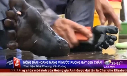 Kinh hoàng nước ruộng nhuộm chân đen xì ở TP HCM