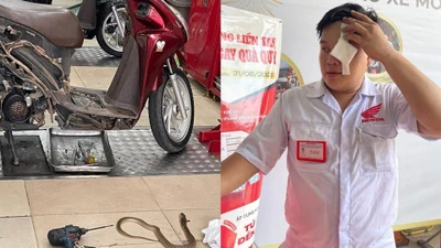Sửa xe giữa trưa, kỹ thuật viên bất ngờ bị rắn phun độc