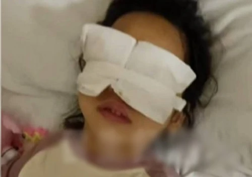Phẫu thuật mắt phải bị mổ cả mắt trái, bệnh viện giải thích sốc 