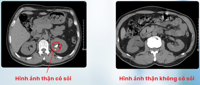 Ảnh BVCC than-doi-1.jpg