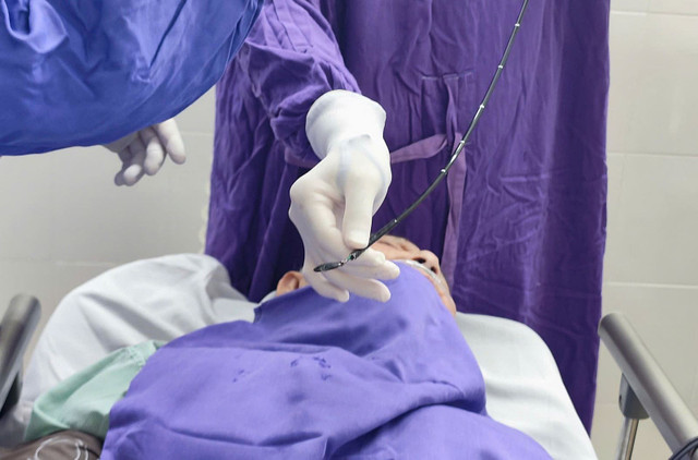 Dị vật nhỏ, trơn nhẵn đòi hỏi bác sĩ phải khéo léo để gắp dị vật ra ngoài nhanh chóng - Ảnh BVCC z6805764228221-cb02eda499b29d2fa1ada7dcda6f1fa6.jpg