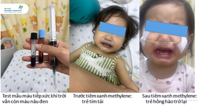 Ảnh BVCC 511303070-1350173680482048-771638648383011821-n.jpg