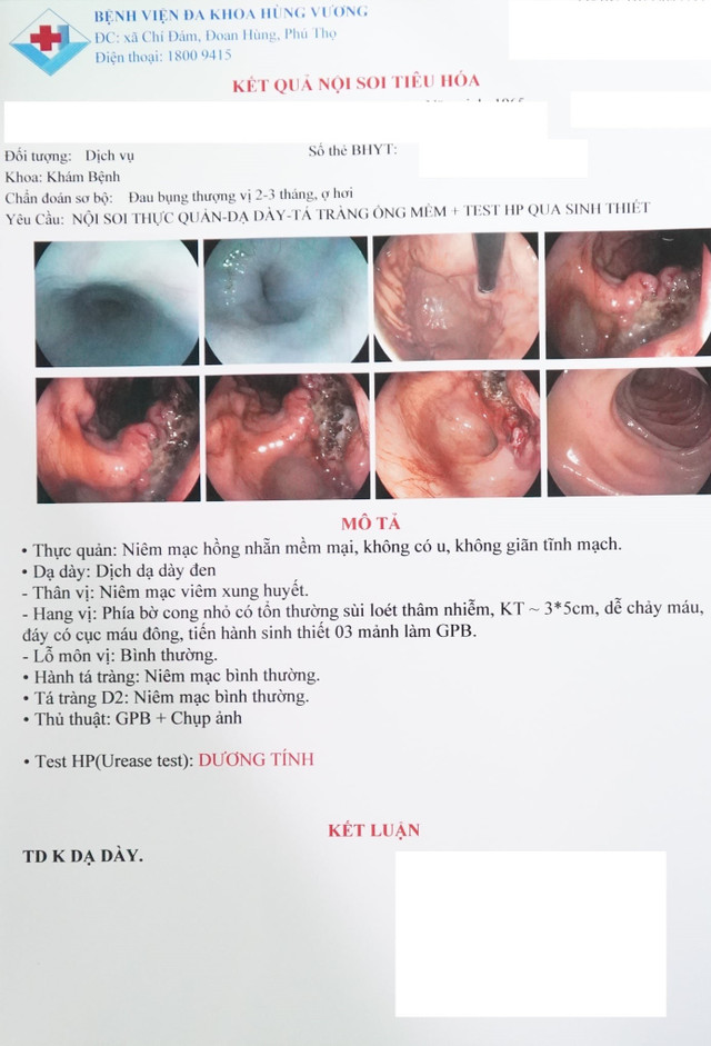 Kết quả nội soi sinh thiết bệnh nhân 36 tuổi bị ung thư dạ dày - Ảnh BVCC noi-soi-som.jpg