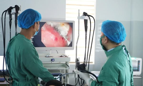 Ca nội soi lấy mảnh nam châm cho bệnh nhi - Ảnh BVCC manh-nam-cham.jpg