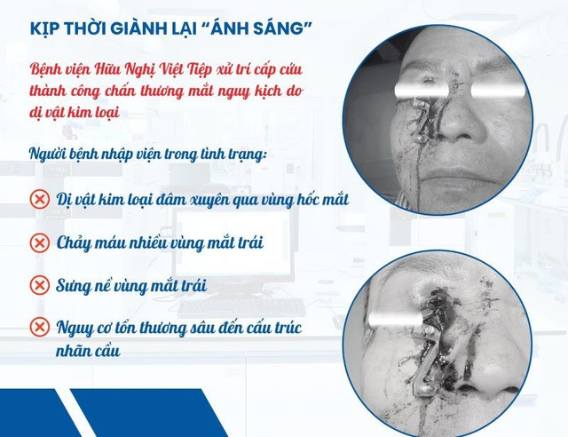 Ca chấn thương mắt nguy kịch - Ảnh BVCC di-vat-mat1.jpg