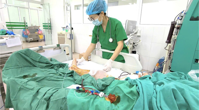 Chân sưng nề căng tức do viêm mô tế bào - Ảnh BVCC nhiem-doc-3.jpg