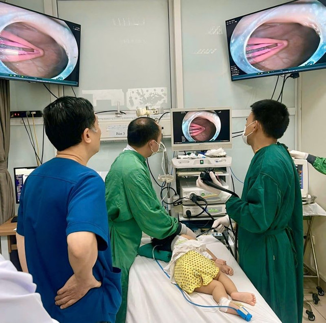 Ca nội soi gắp dị vật cho bé - Ảnh BVCC kep-toc-2.jpg