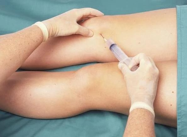 Người bệnh được tiêm nội khớp điều trị thoái hóa khớp gối tại khoa Nội thần kinh – Cơ xương khớp – Bệnh viện Đa khoa tỉnh Phú Thọ thoai-hoa-3.jpg