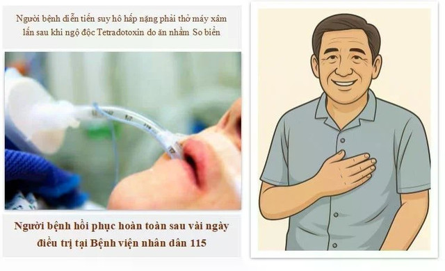 Ngộ độc so biển - Ảnh BSCC so-bien.jpg