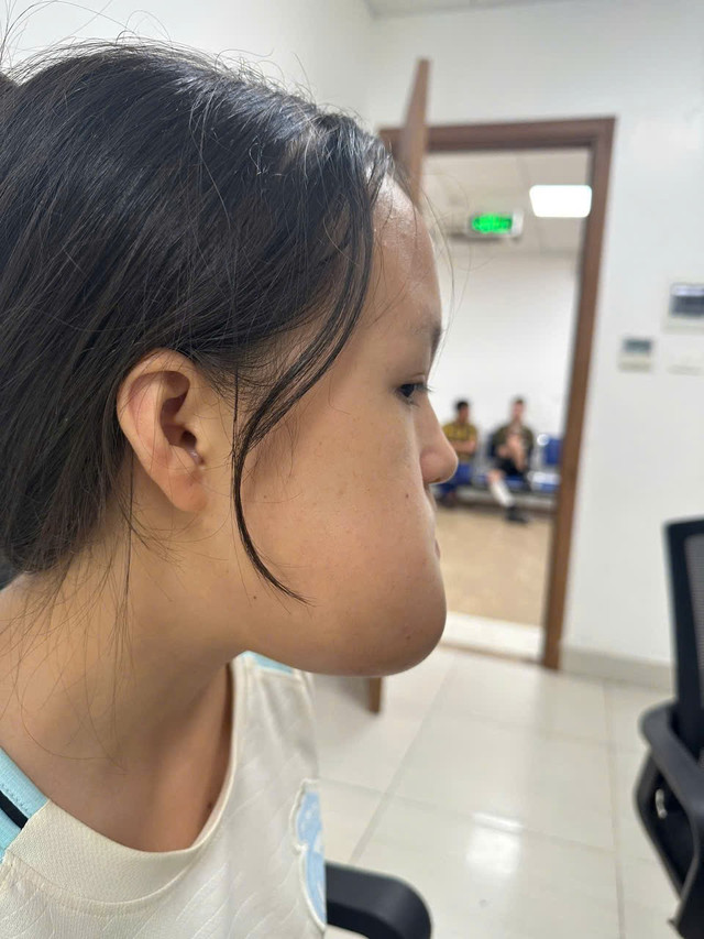 Hình ảnh khối u nguyên bào của bệnh nhân. u-khong-lo.jpg