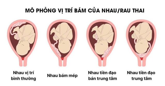 rau-tien-dao-2.jpg