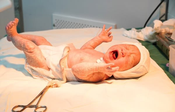 Em bé đã ra đời an toàn, khỏe mạnh - Ảnh BVCC rau-tien-dao.jpg