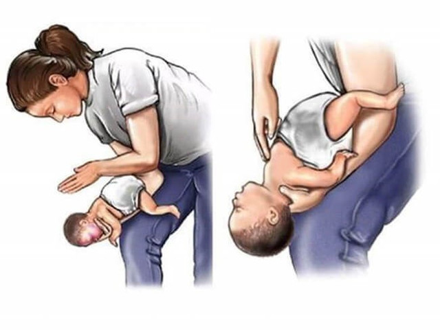 Sơ cứu đúng cách có thể giúp trẻ thoát khỏi nguy kịch khi hóc dị vật - Ảnh: BVCC be-trai-hoc-dau-but-tu-vong-cach-so-cuu-tre-hoc-di-vat-hinh-2.jpg