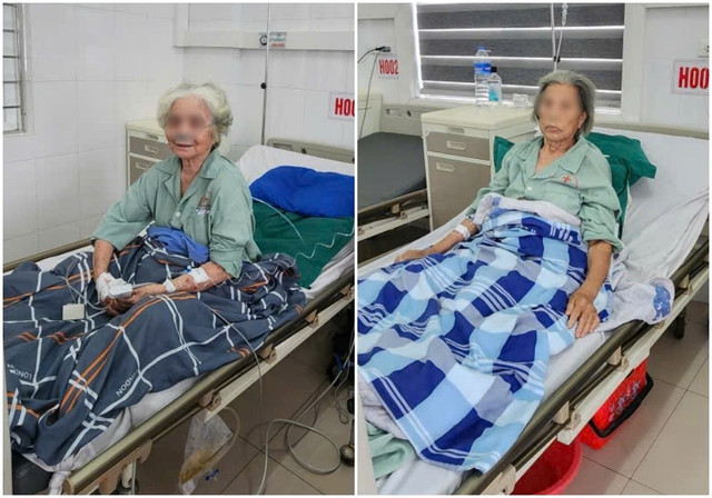 Hai bệnh nhân gãy liên mấu chuyển xương đùi hồi phục tốt sau khi được phẫu thuật bằng kỹ thuật hiện đại. xuong-dui.jpg
