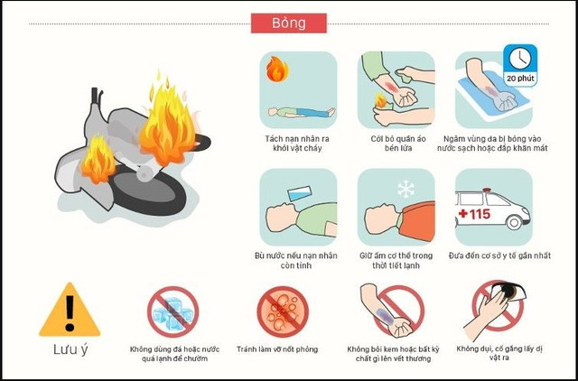 Cách xử lý khi bị bỏng - Hình minh họa BVCC bong-lua.jpg