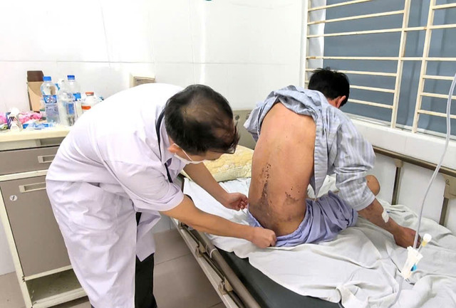 Tổn thương ở lưng của bệnh nhân - Ảnh BVCC bong-rat-3.jpg