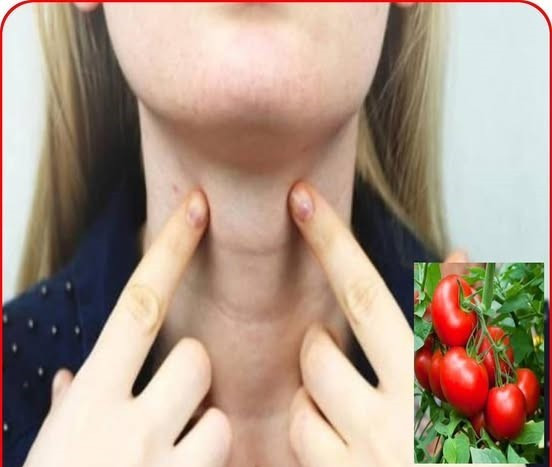 Ảnh hưởng của cà chua tới tuyến giáp - Ảnh BSCC ca-chua-va-tuyen-giap.jpg