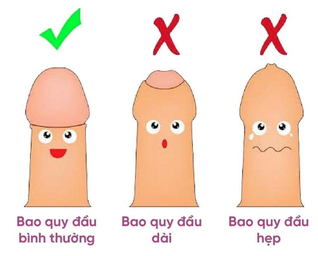Ảnh minh họa nguồn Internet - Ảnh BVCC bao-quy-dau-1.jpg