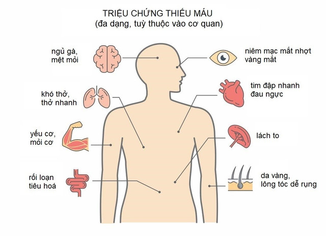 Thiếu máu gây ảnh hưởng đến các cơ quan trong cơ thể - Ảnh minh họa trieu-chung-thieu-mau.jpg