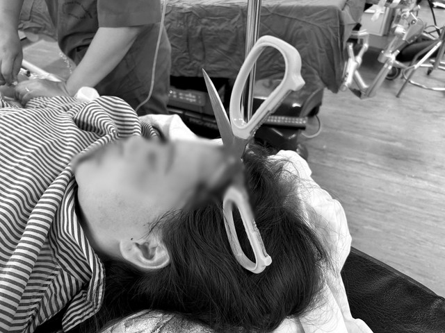 Hình ảnh kéo sắc nhọn đâm xuyên não - Ảnh BVCC bnkeodam-1.jpg