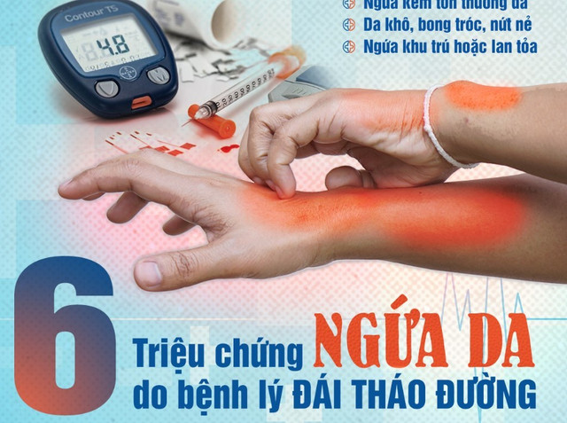 Ảnh bệnh viện cung cấp ngua-da.jpg
