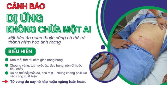 Ăn cơm với cá thu, người đàn ông 32 tuổi sốc phản vệ - Ảnh BVCC ca-kho-thu.jpg