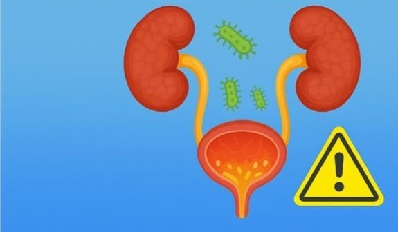 Vi khuẩn xâm nhập gây nhiễm trùng đường tiết niệu - Ảnh BVCC nhiem-khuan-tiet-nieu.jpg