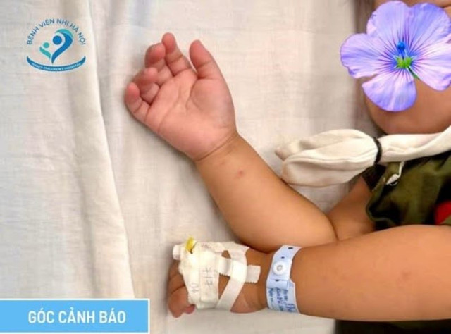 Trẻ 26 tháng tuổi bị ngộ độc thuốc diệt nấm - Ảnh BVCC thuoc-diet-nam.jpg