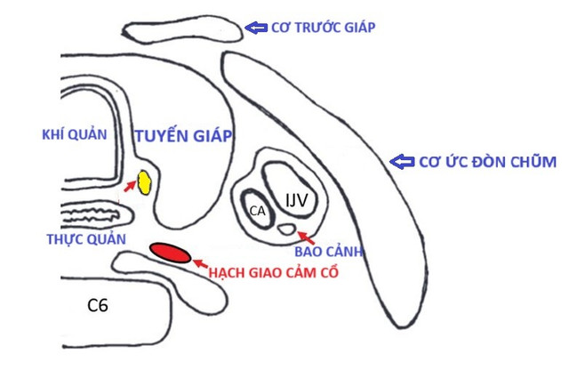 Tổn thương hạch giao cảm - Ảnh BSCC sup-mi-mat-2.jpg