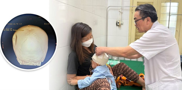 Thăm khám cho bệnh nhân chấn thương sọ não nặng sau phẫu thuật - Ảnh BVCC chan-thuong.jpg