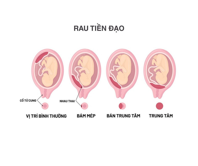 Rau tiền đạo trung tâm - Ảnh minh họa BVCC can-nao-3.jpg
