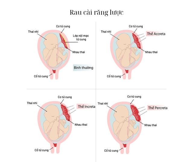 Rau cài răng lược - Ảnh minh họa BVCC can-nao-2.jpg