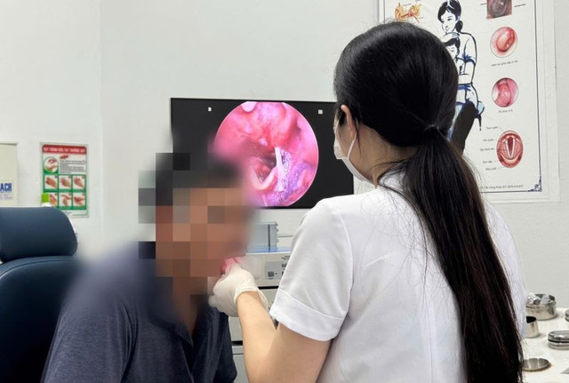BSCKI Trịnh Thùy Liên nội soi phát hiện xương cá trong hạ họng bệnh nhân - Ảnh BVCC ha-hong.jpg