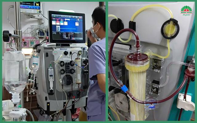 Hệ thống lọc máu trong 49 giờ liên tục giúp bệnh nhân thoát khỏi tình trạng nguy kịch - Ảnh BVCC 49h1.png