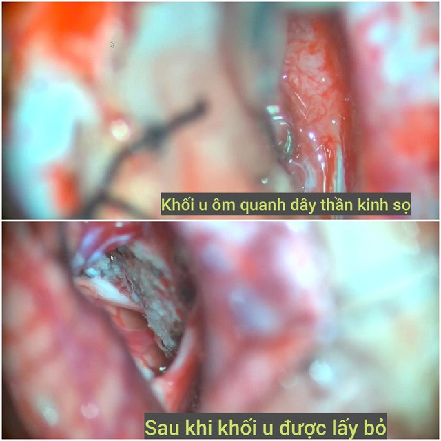 khoiugoctieucaunao-1.jpg