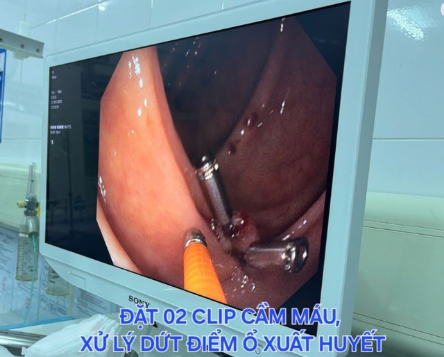 Ảnh BVCC dm-bao.jpg
