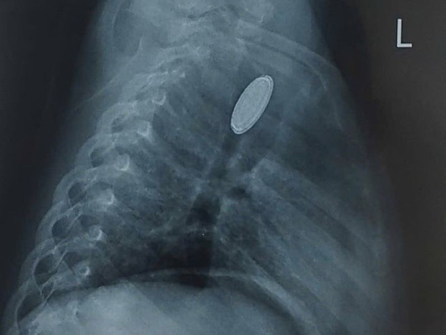 pin-cuc-ao1.jpg