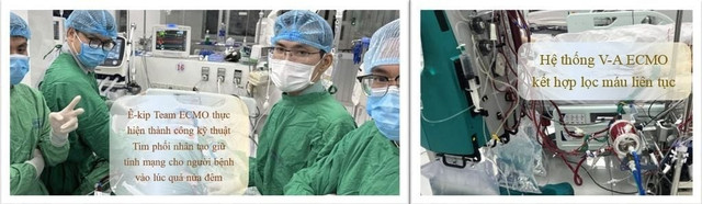 Hình 2. Đội ECMO đang thực hiện kỹ thuật V-A ECMO cho người bệnh ecmo2-716ea427cfdb43d8adb00d53d22eaad8-1024x1024.jpg