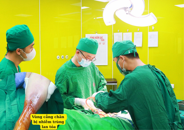 Ca phẫu thuật cho bệnh nhân - Ảnh BVCC mun-nho.jpg