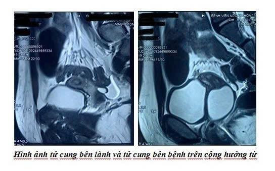 hai-tu-cung-2.jpg