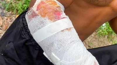 Kinh hoàng: Cá sấu sổng khỏi khu du lịch tấn công người ở Khánh Hòa