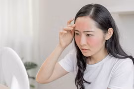 Thói quen tưởng vô hại nhưng khiến làn da xuống cấp 