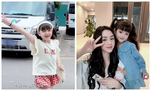 "Con gái màn ảnh" của Quỳnh Kool lên tiếng về tin đồn dao kéo