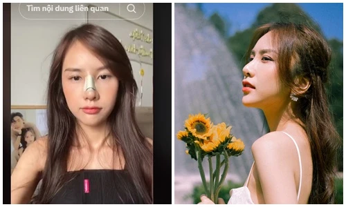 Con gái NSND Trần Nhượng công khai nâng ngực, sửa mũi