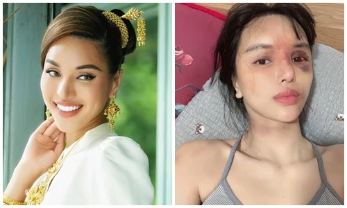 Khả Trang lên tiếng sau vụ bị bạo hành dã man