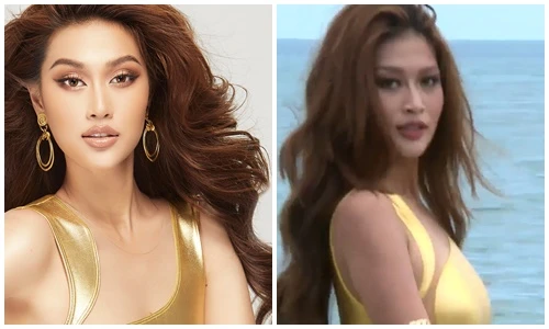 Bị thương ở chân, Đoàn Thiên Ân vẫn tự tin thi bikini