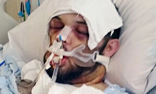 Video: Cận cảnh mục sư Mỹ bị rắn độc cắn vẫn không ngừng thuyết giảng