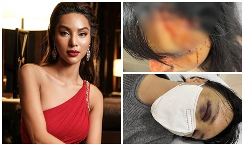 Siêu mẫu Khả Trang tung loạt ảnh bị bạo hành dã man